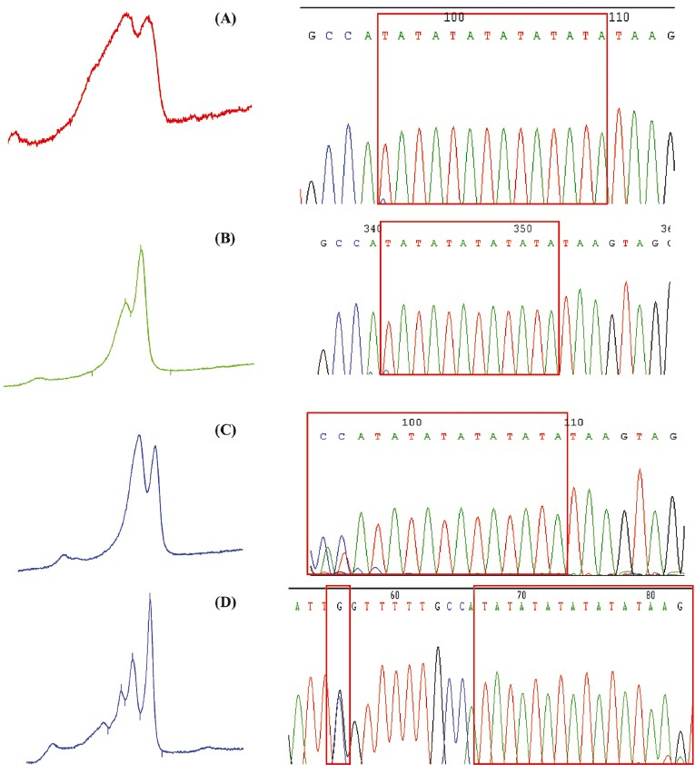 dHPLC peak profiles and sequencing results for the confirmation of insertion of TA box at promoter region of UGT1A1*28. (A) Homozygous for UGT1A1*28; (B) wild-type for UGT1A1*1; (C) heterozygous for UGT1A1*1/*28 (TA6/TA7), (D) combination of heterozygous for UGT1A1*28TA6/TA8 and SNPs at -63 (G>C) known as UGT1A1*68.