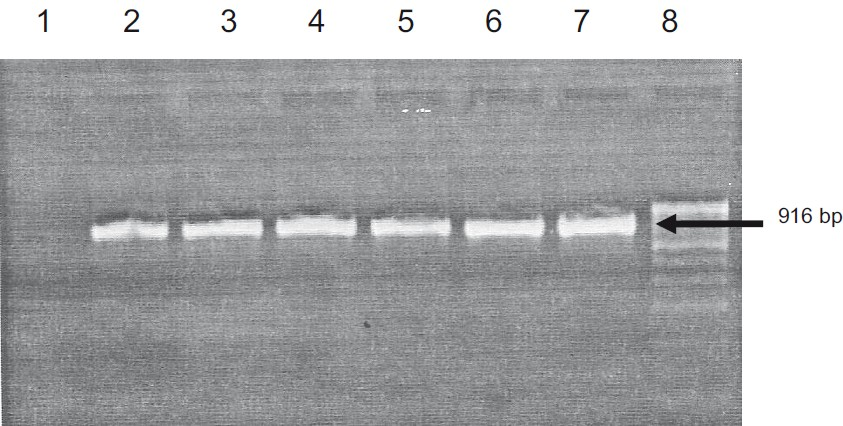 Agarose gel electrophoretogram showing HAdV PCR results of isolates from patients during the epidemic outbreak of acute keratoconjunctivitis. Lane 1: Negative control; Lane 2-6: Isolates; Lane 7: Adenovirus serotype 2 (ATCC (r) 846); Lane 8: Molecular weight marker