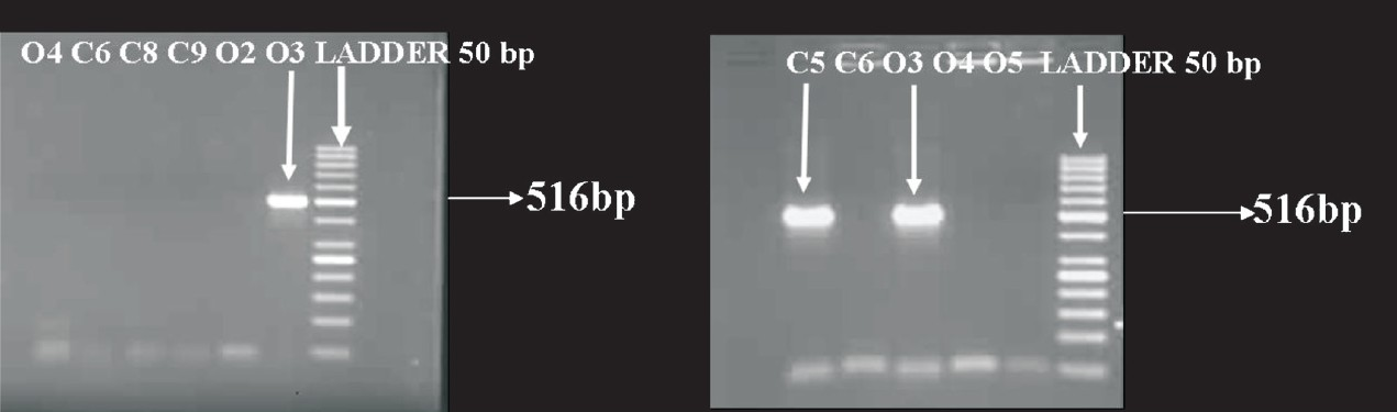 ica gene PCR; Lane C5: Isolate from IV catheter +ve; Lane C6: isolate from IV catheter -ve; Lane 3: isolate from pus +ve; Lane 4 & 5: isolates from pus −ve; Ladder 50 bp.