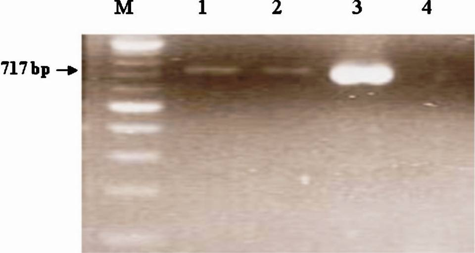 PCR amplified product (TEM) electrophoresed in 1.5% agarose gel. Lane M: 100 bp Ladder, Lanes 1-2: amplification of 717 bp from H. influenzae isolates, Lanes 3: Klebsiella pneumoniae ATCC 700603 and Lane 4: Negative control.