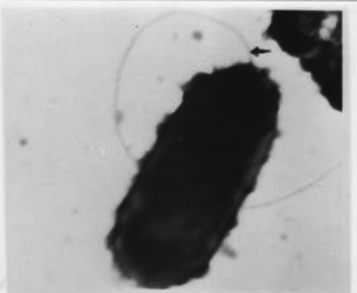 Electron micrograph of Bartonella showing single polar flagella and bleb like projections all over the bacterial surface. 40,000x.