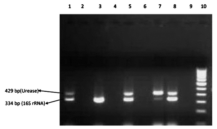 PCR detection of urease and 16S rNA gene. Lane 1 : U. urealyticum positive control (NCTC 10177; urease positive) and M. hominis positive control (NCTC 10111; 16S rRNA positive; Lane 2, 4 and 9: Clinical samples (negative); Lane 3 : Clinical samples (M. hominis positive); Lane 5, 7 and 8 : Clinical samples (U. urealyticum and M. hominis positive); Lane 6 : Negative control; Lane 10: 100 bp ladder
