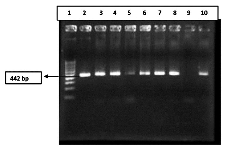 Results of PCR amplification for MBA gene for identification of serovar 3/14; Lane 1: 100 bp marker; Lane 2: Positive control; Lane 3-8, 10: Clinical samples; Lane 9: Negative control.