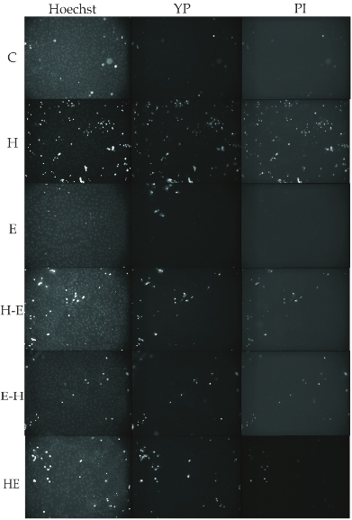 Cell viability assessed by dye exclusion assay in different treatment groups. Each row depicts same microscopic field of the given treatment group taken with 5× objective. Column I shows Ho stained cells. Column II shows cells positive for YP and cells which labelled for PI are shown in column III. Groups as defined in Fig. 1.