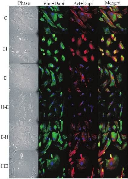 Immunolocalization of cytoskeletal proteins; vimentin and F-actin in different treatment groups with 40 × objective. Each row depicts same microscopic field of the given treatment group. Column I shows phase images of cells. Column II show cells positive for vimentin (green) and cells with F-actin (red) are shown in column III. Column IV shows merged images of column II and III. All the cells are counterstained with DAPI (blue).
