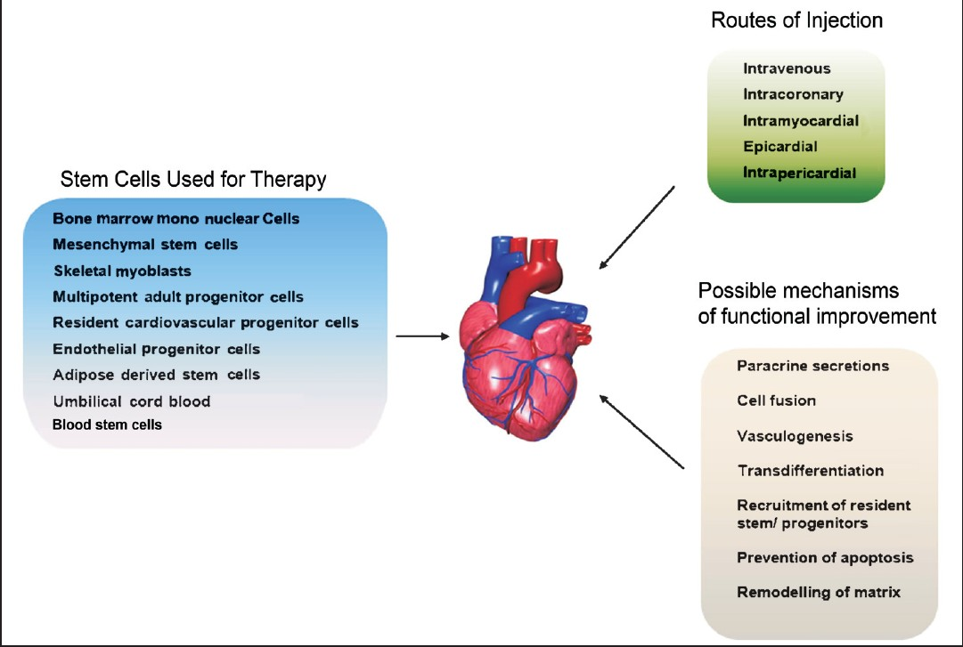 Schematic representation of the various adult stem cell types tested for cardiac regenerative abilities, their mode of action and the various routes of delivery.