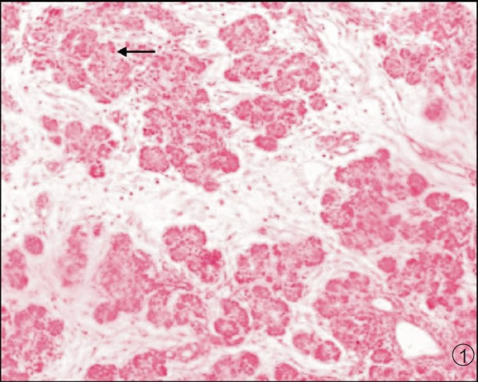 Photomicrograph of pancreas showing acini, ducts and islets (Arrow). H & E X 100.