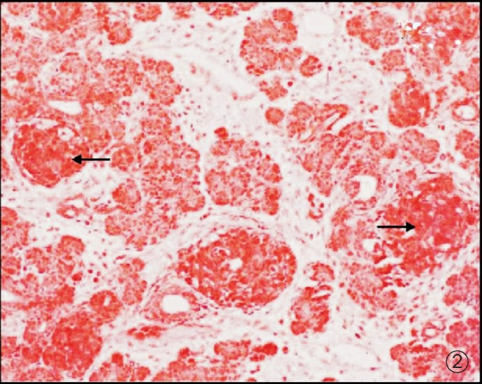 Photomicrograph of pancreas showing acini, ducts and islets (darkly stained - Arrow). Masson trichrome X 100.