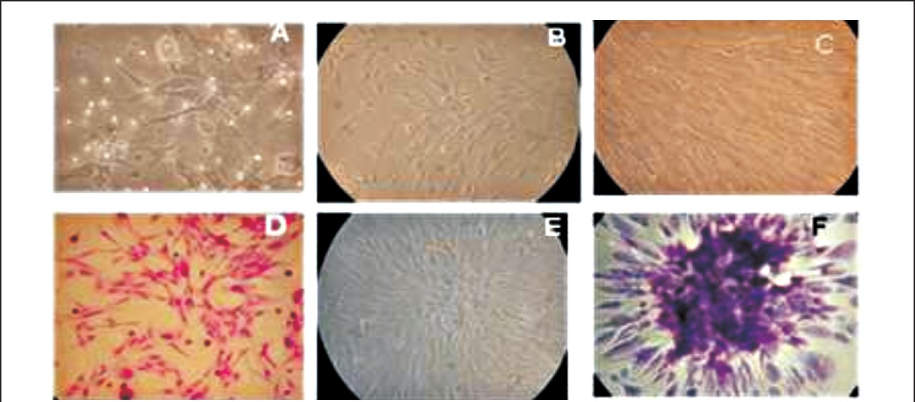 Sheep fetal mesenchymal cells in culture. A. Glistening heterogenous population of MSCs after 24 h (200X). B. MSCs reached 60-70 per cent confluency at 4th day (200X). C. MSCs showing <90 per cent confluency at the 9th day (200X). D. MSCs stained with Hematoxylin and Eosin (H&E) Staining (200X). E. A single colony forming unit (cfu) of MSC (200X). F. A single cfu stained with H&E (200X).
