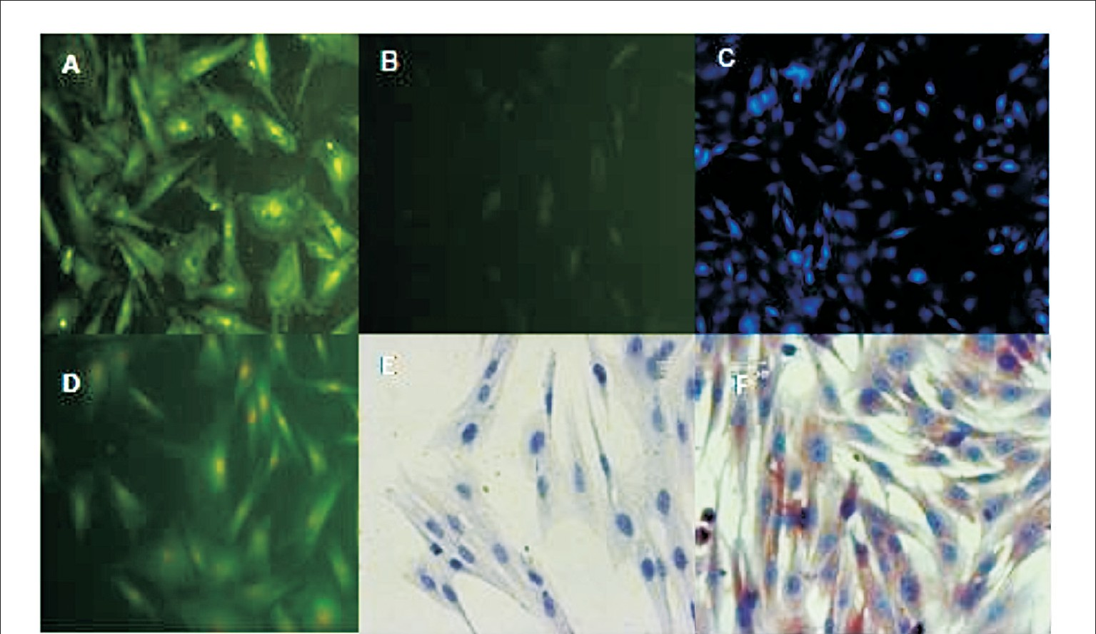 Cellular antigenic characterization of Sheep fetal Mesenchynial Cells-Immunostaining (200 ×). A. Fetal MSCs stained positive for intra-cellular collagen type I/III expression (FITC), B. Lack of fluorescence in negative controls (FITC), C. MSCs stained positive for CD 44 (Immuno fluorescence, DAPI stained (100×) D. MSCs stained positive for integrinβ1 (FITC), E. MSCs stained negative immunocytochemistry for CD 45 F. MSCs stained positive immunocytochemistry for fibronectin.