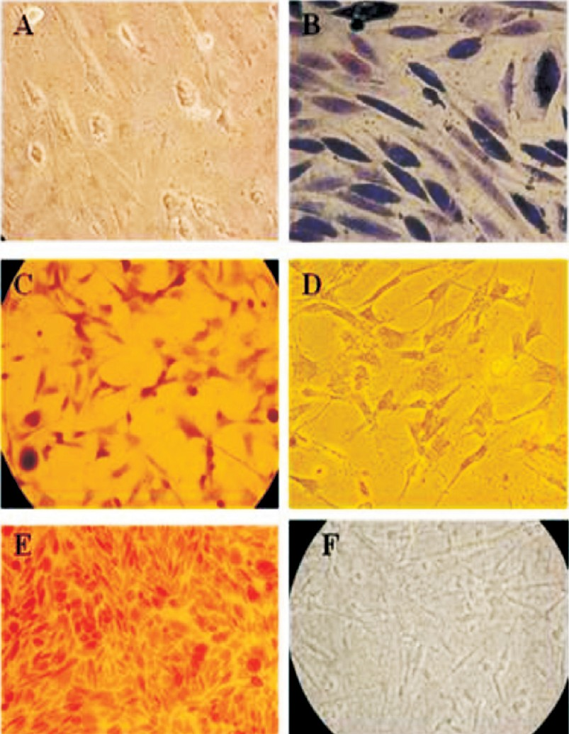 Differentiation of ovine fetal mesenchymal stem cells-special staining. A. Differentiation of MSCs showing flattened and polygonal shapes (200×). B. Masson trichrome staining (200×). C. Alkaline phosphatase staining (100×). D. Negative staining for Alkaline phosphatase (100×). E. Von Kossa staining showing positive for calcium deposition (100×). F. Von Kossa staining showing negative for calcium deposition in undifferentiated MSCs (200×).