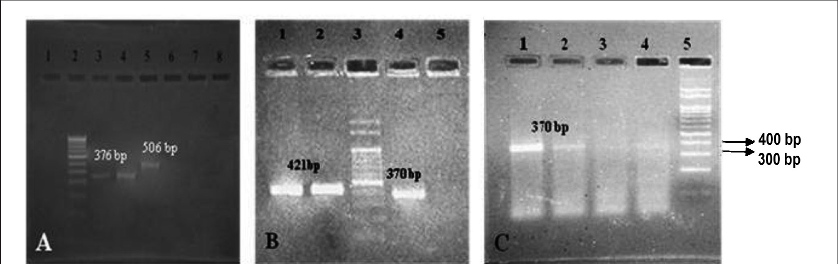 Gene expression analysis of MSC induced for osteogenic lineage and un-induced MSCs. 100 bp Marker- A lane 2, B lane 3, and C lane 5. RAB3 gene- 506 bp, Osteopontin- 421 bp, MMP13- 1376 bp, and Collagen type 1-370 bp. Supernatant containing floating cells processed for gene expression analysis were loaded in the Lane 7, 8 in A, Lane 5 in B and Lane 3, 4 in C showed negative expression for the MSC and MSC derived osteogenic lineage genes.