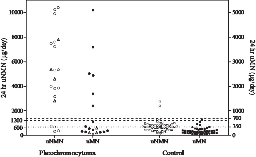 Cut-off values for 24 h urinary metanephrine (μMN) and normetanephrine (μNMN) in μg/day. The dotted lines represent the cut-off values defined by the upper limit of normal as stated by the assay manufacturer and the broken lines twice the upper limit. In the phaeochromocytoma group, circles (O) and triangles (Δ), adrenal and extra-adrenal tumour, respectively. (□), urinary normetanephrine levels in controls. (■), urinary metanephrine levels in controls.