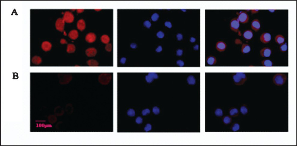 Detection of the PARP-1 protein expression in C13* cells by Immunofluorescent microscopy. (A) PARP-1 protein expression and localization in C13* cells (red). (B) PARP-1 protein expression and localization in C13* cells after treated with 5 mmol/l 3-AB (red) for 24 h. Nuclei stained with DAPI (blue). Original magnification, × 400.