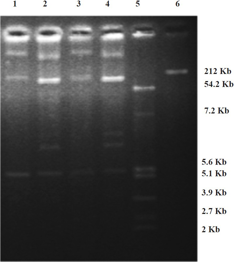 Plasmid profiles of test isolates and transconjugants of E. coli and K. pneumoniae hourbouring blaCTX-M-15. Lanes 1 & 2: transconjugant of E. coli and test isolate of E. coli from blood of neonates, respectively. Lanes 3 & 4: transconjugant of K. pneumoniae and test isolate of K. pneumoniae from blood of neonates, respectively. Lanes 5 & 6: E. coli K12 V517 and Shigella flexneri YSH 6000 were used as reference standards respectively.