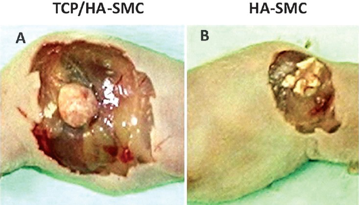 The diagram shows the formation of bone in the in vivo system (athymic mice). (A). TCP/HA-SMC showed a significant change in shape compared with the HA-SMC construct. A smooth outer surface and the hard structure was felt with the fingers. (B). HA-SMC constructs showed no change and still maintain its form.
