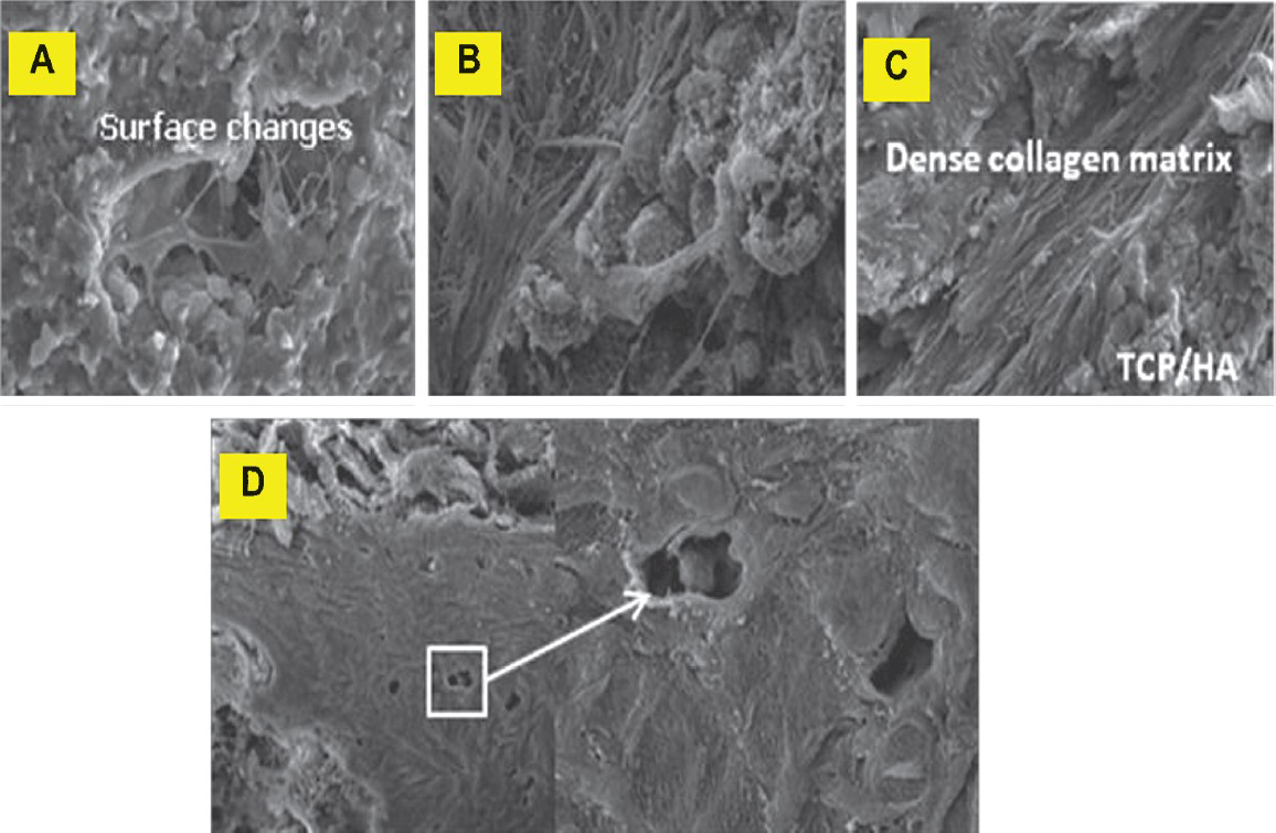 Scanning electron micrographs of TCP/HA-SMC scaffolds. Development of osteoblasts was seen to progress along with the development of extracellular matrix (ECM) in threee phases; cell proliferation with ECM secretion (A and B), ECM maturation (C) and finally, ECM mineralization (D) (arrow).