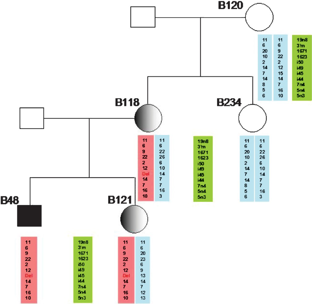 Figure showing the use of STR-(CA) segregation repeat analysis for carrier detection in a family with DMD. CA-repeat microstatellite markers flanking the DMD gene locus were used for haplotyping. The affected polymorphic allele showing the deletion of intron 45 is shown in pink. In this family the proband showed exon 45 deletion of the DMD gene. It can be observed that the affected haplotype (in pink) from the mother being transmitted to both the index case his female sibling.