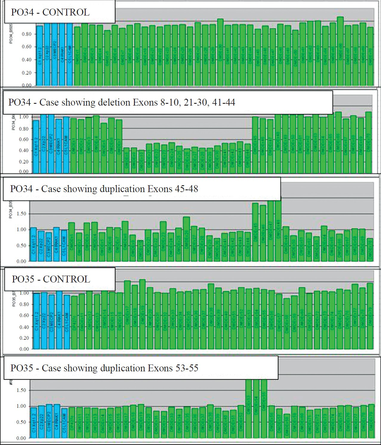A representative figure showing MLPA results in a normal control, proband and his carrier mother for probes PO34 and PO35. The x-axis displays the exons and the DQ is in the y-axis. Deletion can be seen as a reduction in DQ to around a value of 0.5 and in duplication DQ can be seen more than 1.5.