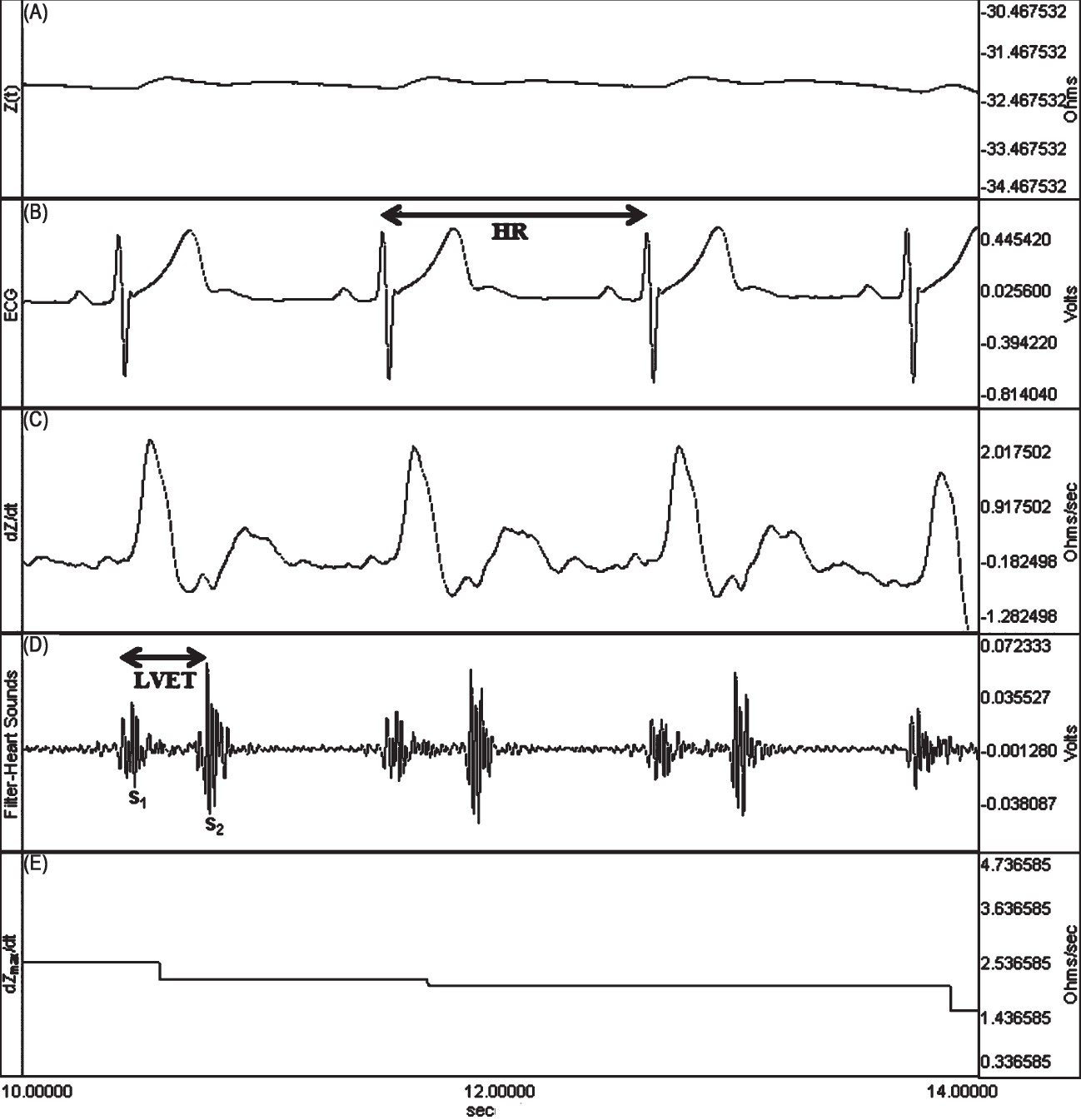 The simultaneous recordings of thoracic electrical bioimpedance in an athlete. (A) Z0 (steady-state basal impedance). (B) HR (heart rate) (C) dZ/dt (rate of impedance change) (D) LVET (left ventricular ejection time) (E) dZmax/dt (maximum rate of impedance change).