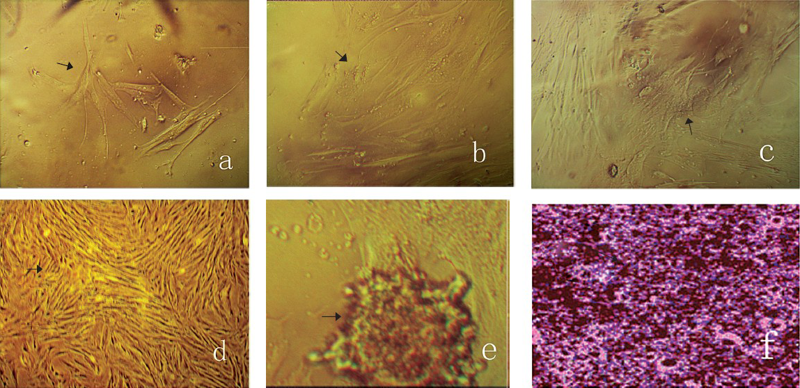 The growth state of BMSCs cultured in medium with the additional supplementary of different growth factors after five days culture (arrows). a: Control; b: 80 ng/ml BMP-4/7; c: 80 ng/ml bFGF; d: 30 ng/ml BMP-4/7+30 ng/ml bfGF; e: 50 ng/ml BMP-4/7+50 ng/ml bFGF; f: 80 ng/ml BMP-4/7+80 ng/ml bFGF