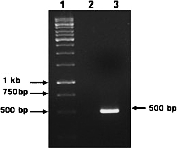 Agarose gel electrophoresis showing the amplification of the expected 500 bp PCR product. Lane 1 - Molecular weight marker (1 Kbp DNA ladder); Lane 2- Negative control (No template); Lane 3 - Positive control (Novel ECSA genotype).