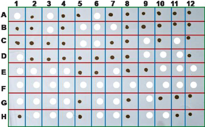The dot blot analysis of the human patient acute phase serum and CSF samples for the presence of genomic RNA of chikungunya virus employing the CHIK E 1 specific biotinylated DNA probe. The appearance of brown colour dot following colour development with DAB chromogen confirmed the presence of chikungunya virus. The blank space shows negative result indicating the absence of chikungunya virus.