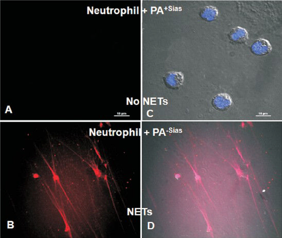 Visualization of neutrophil extracellular traps (NETs) by confocal microscopy. PA was incubated with neutrophils. Neutrophil extracellular traps (NETs) were visualized under confocal microscopy after stained with Sytox orange (DNA stain for dead cell) only as well as both with DAPI (nuclear stain) and Sytox orange. No NET formation was observed when PA+Sias was incubated with neutrophils (A-C). In contrast, NETs formation was visualised after incubating PA-Sias with neutrophils followed by staining with Sytox orange only (B) as well as DAPI and Sytox orange together (D). Reproduced with permission from Society for Leukocyte Biology, Bethesda, USA (J Leukoc Biol 2012; 91: 641-55).