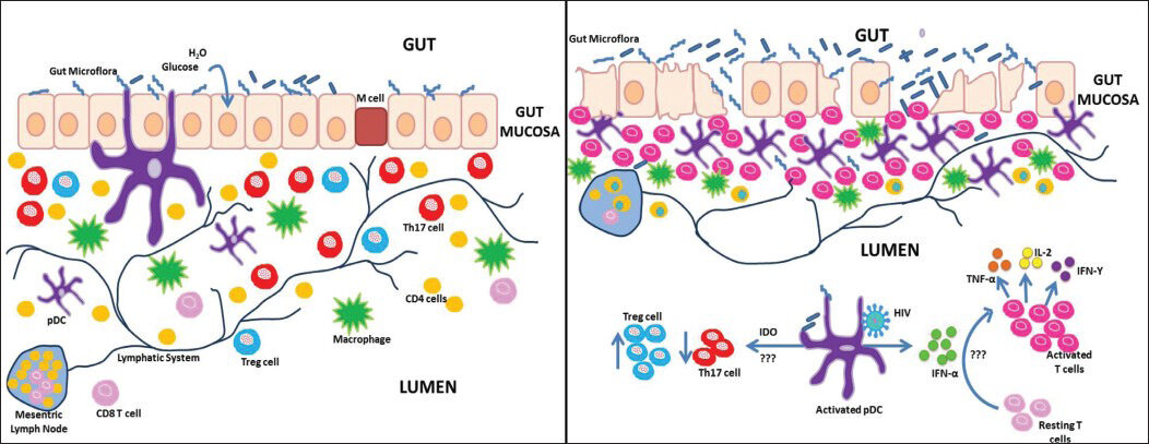 Hypothetical model of gastrointestinal tract (A) Normal Healthy state and (B) chronic HIV infection. (A) In a normal healthy state, the epithelial and M cells lining the mucosal barrier of the gastrointestinal tract forms an effective barrier against invading pathogens. The lamina propria contains loose clusters of T cells, macrophages, plasmacytoid dendritirc cells (pDCs) and follicles. (B) During chronic HIV infection, the mucosal barrier lining the gastrointestinal tract becomes leaky facilitating translocation of microbial products. This results in increased infiltration of inflammatory cells into the lamina propria leading to more proinflammatory cytokine production. Lipopolysaccharide has been reported to activate IFN-α and Indoleamine 2, 3 dioxygenase (IDO) production by (pDCs) promoting immune activation and a shift in the balance from Th17 to Treg population by unknown mechanisms.