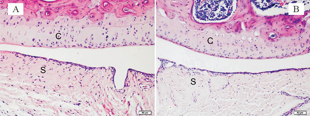 Histopathological difference between the knee joints of rats 48 h after injection in Group I (dexketoprofen trometamol) (A) and Group II (control) (B). C, cartilage; S, synovium; H&E staining. 200×.