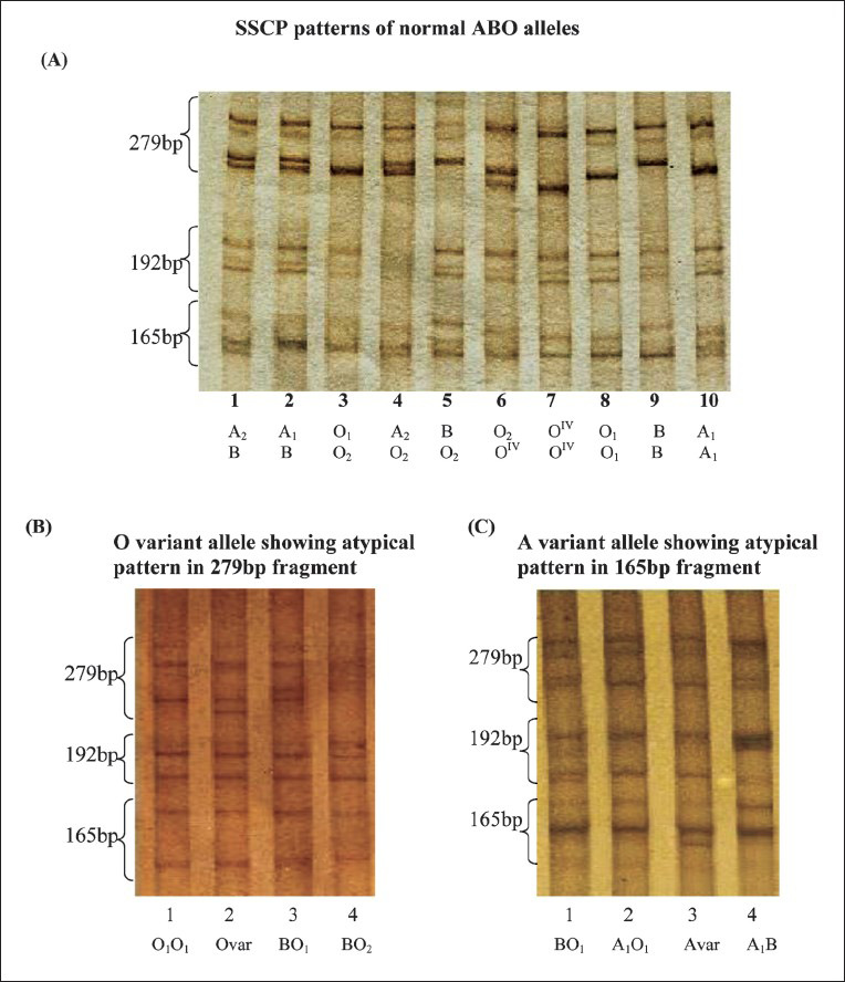 SSCP patterns of common as well as variant ABO alleles. Fig. (A) shows the single strand conformational polymorphism (SSCP) patterns of different homozygous and heterozygous ABO alleles (Lane1-10: A2B, A1B, O1O2, A2O2, BO2, O2OIV, OIVOIV, O1O1, BB & A1A1). Fig. (B) shows the normal SSCP pattern of ABO alleles (lane 1, 3, 4) Lane 2: Atypical pattern of O variant allele. Fig. (C) shows the normal SSCP pattern of ABO alleles (lane 1, 2, 4) with atypical pattern of A variant allele (lane-3).