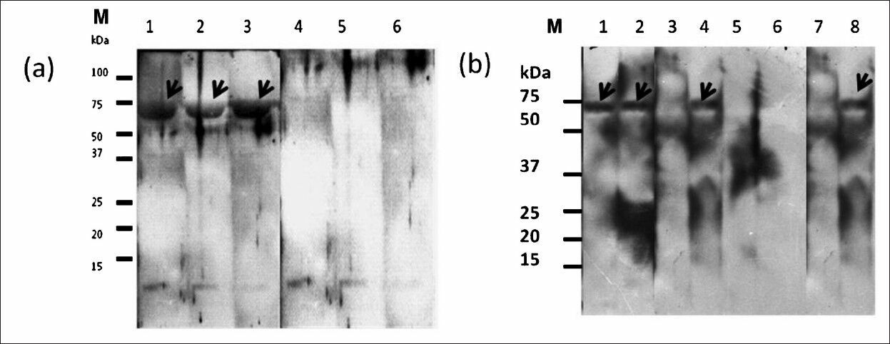 Representative IgM Western blot results of r72SEQ probed with serum samples from leptospirosis patients with various serogroups and control serum samples. (a) Lane (1) Djasiman serogroup, (2) Bataviae serogroup, (3) Autumnalis serogroup, (4) dengue patient serum, (5) amoebic liver abscess patient serum, (6) typhoid patient serum, M, molecular weight markers. (b) Lane (1) Icterohaemorrhagiae serogroup, (2) Javanica serogroup, (3) Toxoplasmosis patient serum (4) Australis serogroup, (5) healthy blood donor serum, (6) dengue patient serum, (7) typhoid patient serum, (8) Pomona serogroup, M, molecular weight markers.