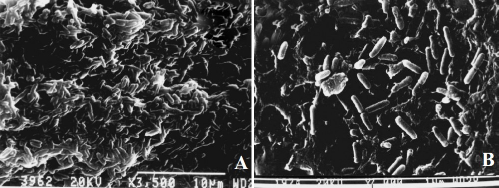 Photomicrograph showing the results of scanning electron microscopy of four day old biofilm grown on catheter surface by Pseudomonas aeruginosa in absence and presence of sub-inhibitory concentration of cranberry. Large amount of exopolysaccharide in control cells (A; X3500) and less amount of exopolysaccharide in cranberry treated and bacterial cells are clearly visible (B; X3500).