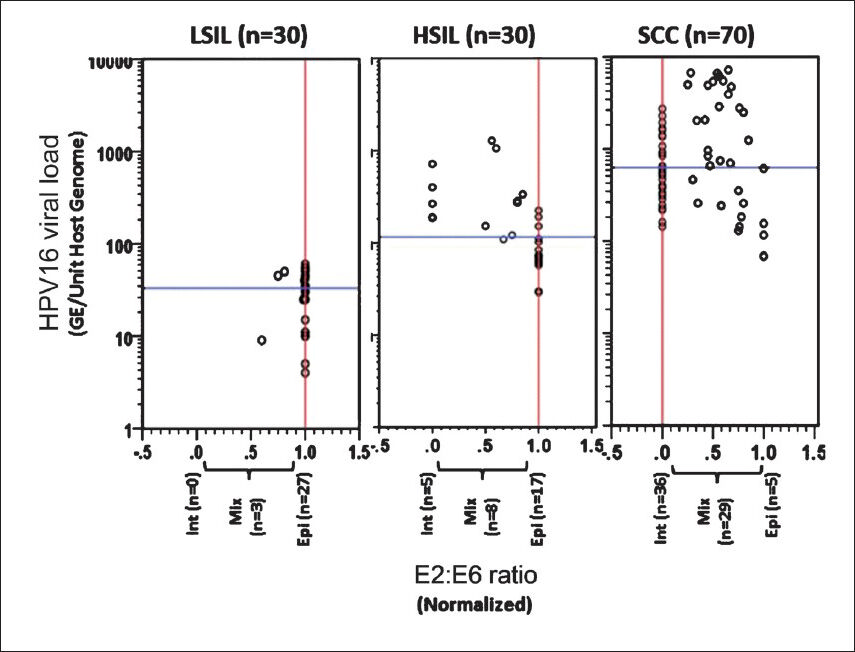 Association of HPV16 physical state with the viral load in different precancer and cancer cases. Distribution of normalized HPV16 E2:E6 ratio and HPV 16 viral load in cervical precancer (LSIL and HSIL) and cancer cases. Each circle indicates individual case. Normalized E2:E6 ratios and viral load were calculated as described in Methods. Normalized E2:E6 = 0 represents completely integrated HPV16; E2:E6 = 1 represents episomal viral genome, E2:E6 between 0 and 1 indicates concomitant HPV16 genome. Vertical red line and horizontal blue line represent median values of E2:E6 ratio and HPV16 viral load in each disease group, respectively.