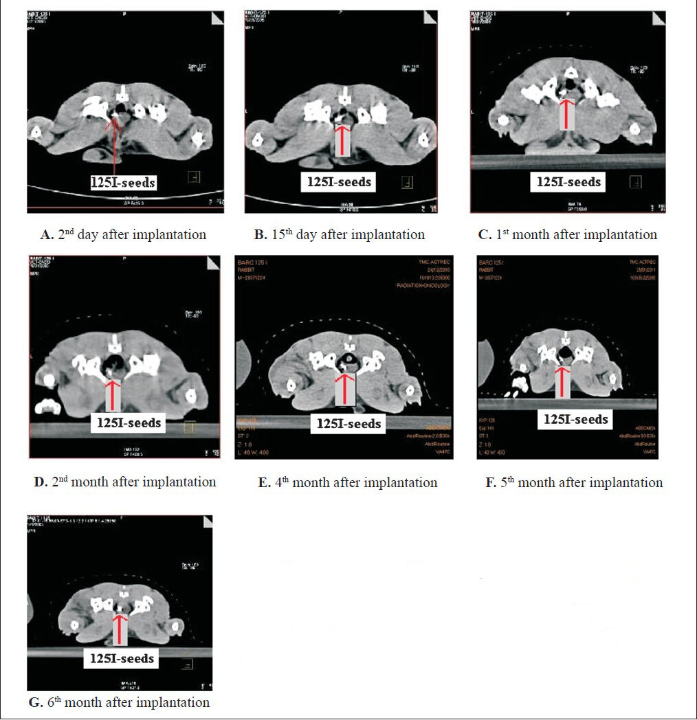 Serial CT images of the rabbit showing the implanted with seeds together maintaining their position within the prostate gland. (A) 2nd day after implantation. (B) 15th day after implantation. (C) 1st month after implantation. (D) 2nd month after implantation. (E) 4th month after implantation. (F) 5th month after implantation. (G) 6th month after implantation.