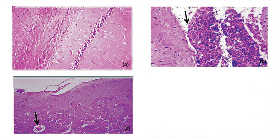 Effect of Sidh Makardhwaj on cerebrum histology. Lingh micrograph of (a) control brain cerebrum showing normal architecture (b) 1 mg/kg/day, HgCl2 treated rat showing pyknosis, congestion of blood vessels and necrosis of Purkinje cells (arrow) (c) 100 mg/kg/day, Sidh Makardhwaj treated showing pyknosis of neurons and congestion of blood vessels (arrow). Original magnification 20X.