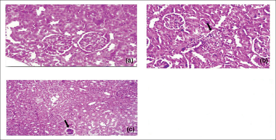Effect of Sidh Makardhwaj on rat's kidney histology. Light micrograph of (a) control liver showing normal architecture (b) 1 mg/kg/ day, HgCl2 treated showing pyknosis, vascular, degenerative and necrotic changes in the liver (arrow) (c) 100 mg/kg/day, Sidh Makardhwaj treated showing pyknosis and congestion of blood vessels (arrow). Original magnification 20X.