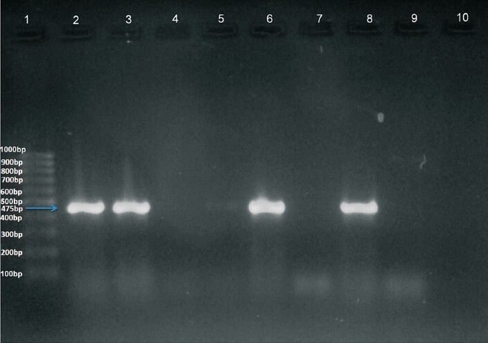 Amplified DNA after PCR with specific primers. Lane 1: 100 bp ladder. Lane 2: Positive control (Klebsiella pneumoniae BAA2156). Lanes 3, 6 and 8: Clinical isolates showing positive result. Lanes 4, 5, 7 and 9: Clinical isolates showing negative result. Lane 10: negative control (Escherichia coili 25922).
