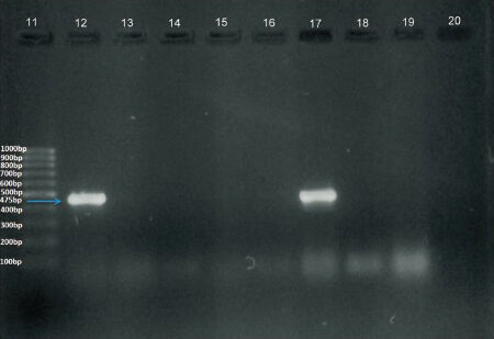 Amplified DNA after PCR with specific primers. Lane 11: 100 bp ladder. Lane 12: Positive control (Klebsiella pneumoniae BAA2156). Lanes 13 to 16, 18, 19: Clinical isolates showing negative result. Lanes 17: Clinical isolates showing positive band. Lane 20: (Escherichia coili 25922).
