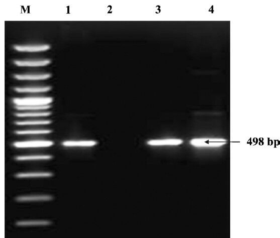 Detection of cnf1 gene by PCR. Lane M: DNA ladder (100 bp); Lane 1: positive control (498 bp); Lane 2: Negative control; Lanes 3 & 4: Positive isolates.
