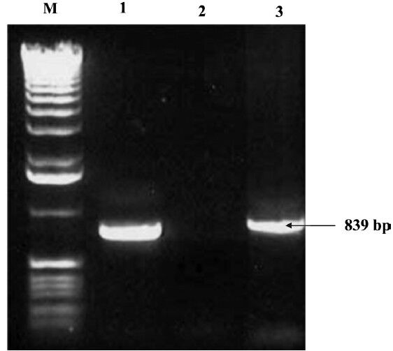 Detection of cnf2 gene by PCR. Lane M: DNA ladder (1 kb); Lane 1: positive control (839 bp); Lane 2: Negative control; Lane 3: Positive isolates.