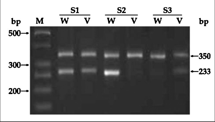 Allele specific (AS)-PCR analysis of IL-10 (-819/-592) in some representative samples (S1-S3). Lane M: 50 bp DNA ladder; 350 bp band in all lanes: Internal control (β-actin): S1: CC/TA genotype; S2: CC/CC genotype; S3: TA/TA genotype. S: sample, W: wild allele and V: variant allele.