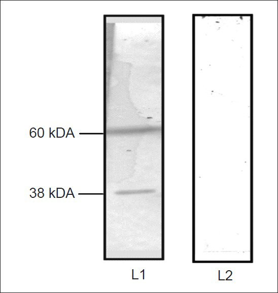 Virus overlay protein binding assay with CHIKV. The molecular weights of CHIKV binding proteins are shown on the left side. Lane L1-incubated with CHIKV, L2 – incubated with PBS, pH 7.4