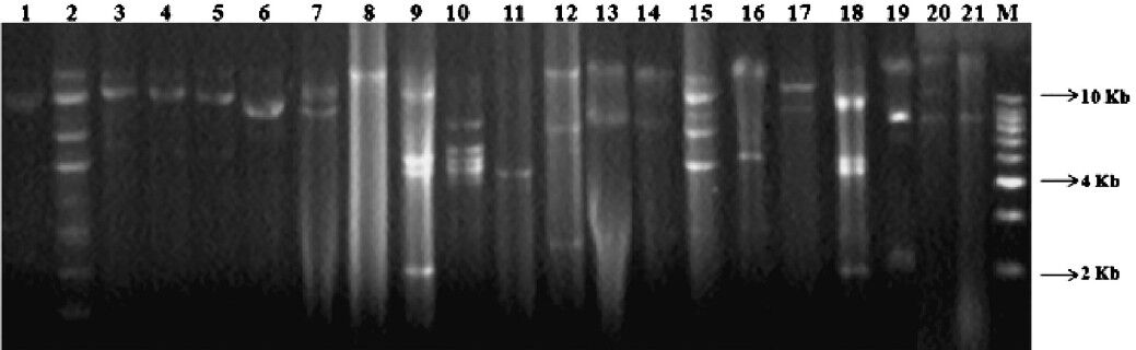 Plasmid profiles of representative MDR A. baumannii isolates bearing single and multiple numbers of plasmids. (a) Lanes 1, 3-7, 17 (strain IDs P1, P4, P5, P6, P9, P11, P35) depict strains containing two plasmids of sizes greater than ≥ 10Kb and lane 16 containing two plasmids, one is of 5Kb and another of ≥ 10Kb size; (b) Lanes 13, 14 & 21 depict strains (P20, P3 & P23) containing two plasmids, one ≥ 10Kb and another of 8Kb size; (c) Lane 2 depicts strain (P2) containing multiple plasmids (n=9); (d) Lane 8 depicts strain (P12) harbouring single plasmid with molecular weight greater than 10Kb; Lane 11 depict strain (P16) harbouring single plasmid with molecular weight of 5Kb; (e) Lanes 9, 10 and 18 represents strains (P13, P14, P48) harbouring four plasmids of size varying from 2Kb to 10Kb; (f) Lane 12, 19 and 20 (strain IDs P17, P28, P22) contains three plasmids of size varying from 2Kb to >10Kb; (g) Lane 15 shows strain (P10) containing five plasmids of size varying from 5Kb to >10Kb.