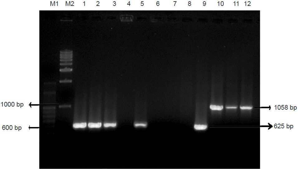 PCR amplification of blaOXA-51 and blaOXA-23. Lane M1 - 100bp DNA ladder, Lane M2 - 1kb DNA ladder, Lane 1, 2, 3, 5 & 9 Positive amplification of blaOXA-51 (Isolate ID: P24, P25, P26, P28, P37); Lane 4, 6, 7 & 8 (P27, P29, P33, P36) Isolates showing no amplification of blaOXA-51; Lane 10-12 - Positive amplification of blaOXA-23 (P2, P19, P41).