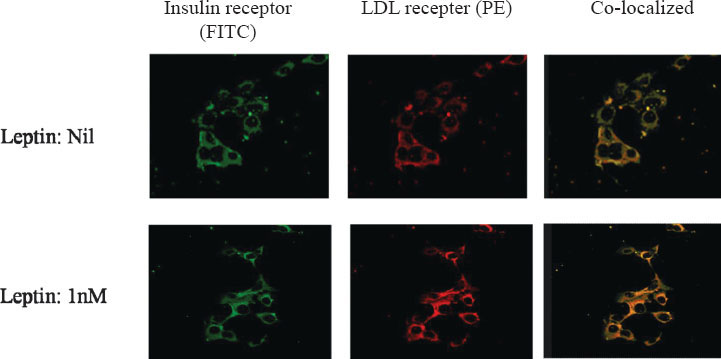 Confocal microscopy showing effect of leptin on co-localization of LDL receptor and insulin receptor. Insulin receptor was stained with FITC (Fluorescein sothiocyanate; green) and LDL receptor was stained with PE (Phycoerythrin; red). The co-localization of the two receptors (green and red) was observed as yellow colour. The density of yellow colour was increased with 1nM leptin. This showed increased co-localization with leptin.