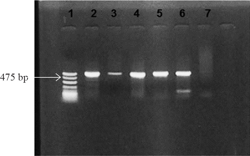 PCR for detection of blaNDM-1. Lane 1: molecular mass marker (100bp DNAladder); Lane 2: positive control; Lanes 3-6: blaNDM-1 positive isolates (amplicon size- 475bp); Lane 7: negative control.