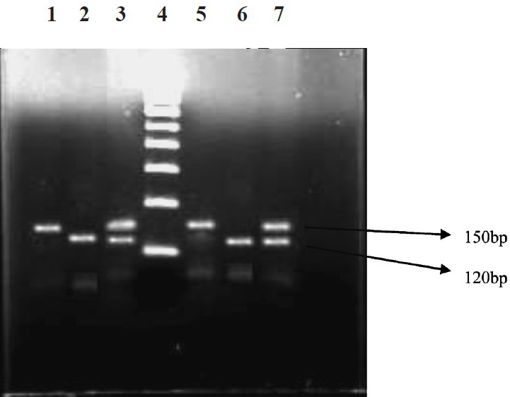 RFLP products of MMP-7 (-181 A/G) genotypes. Lanes 1&5-homozygous A/A (150 bp); lanes 2&6-homozygous G/G (120 bp); lanes 3&7-heterozygous A/G (150 bp/120 bp); lane 4- 100 bp ladder.