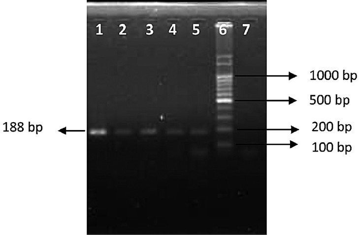 PCR results with patient samples (opa). Lane 1: N. gonorrhoeae (ATCC 49226), Lanes 2-5: Patients samples, Lane 6: 100 bps ladder, Lane 7: Negative control. Lanes 1-5 were positive.