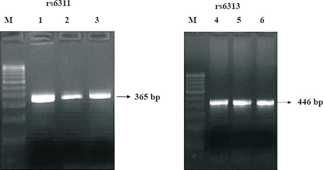 PCR amplicons of 5HT2A SNPs. M, 100 bp marker; Lanes 1 - 3, PCR amplicons of rs6311; Lanes 4-6, PCR amplicons of rs6313.